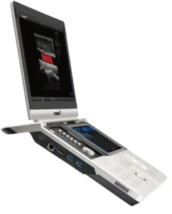 Portable-Ultrasound.webp